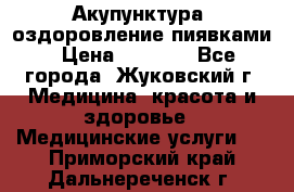 Акупунктура, оздоровление пиявками › Цена ­ 3 000 - Все города, Жуковский г. Медицина, красота и здоровье » Медицинские услуги   . Приморский край,Дальнереченск г.